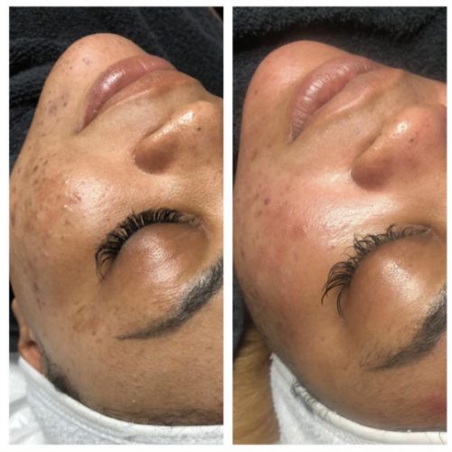 Soins nettoyants de la peau institut de beauté à Grésy sur Aix