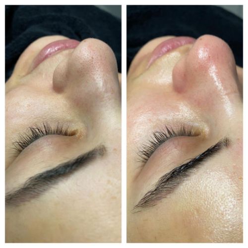 Soins nettoyants de la peau institut de beauté à Grésy sur Aix