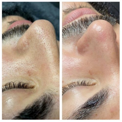 Soins nettoyants de la peau institut de beauté à Grésy sur Aix