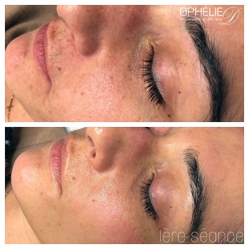 Soins traitants de la peau - Institut de beauté à Grésy sur Aix