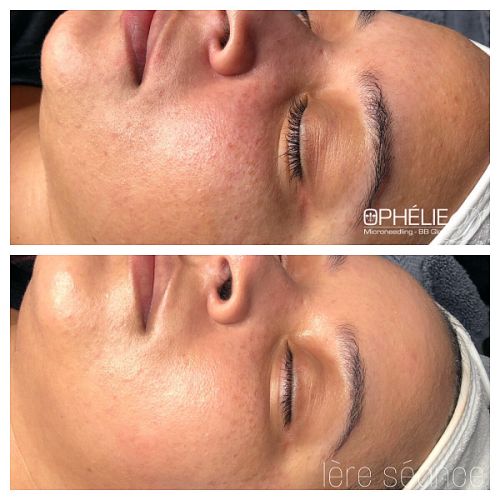 Soins traitants de la peau - Institut de beauté à Grésy sur Aix