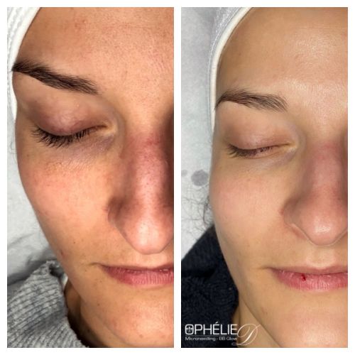 Soins traitants de la peau - Institut de beauté à Grésy sur Aix