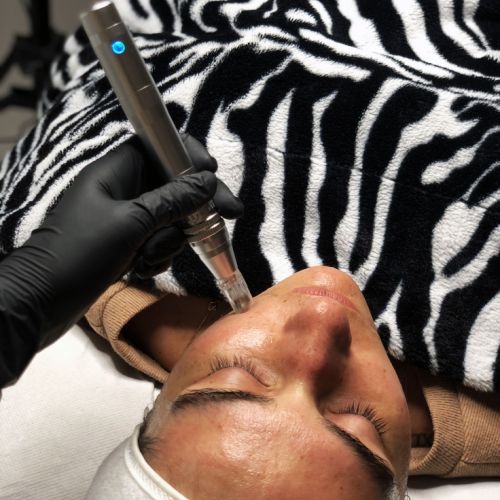 Soins traitants de la peau - Institut de beauté à Grésy sur Aix