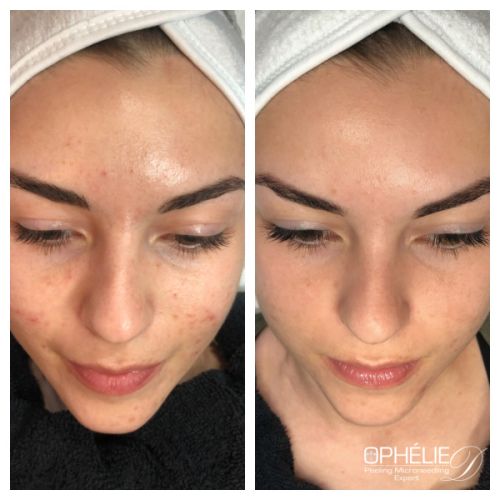 Soins traitants de la peau - Institut de beauté à Grésy sur Aix