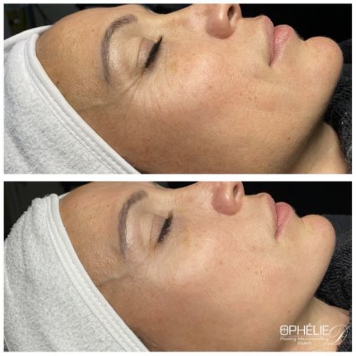 Soins traitants de la peau - Institut de beauté à Grésy sur Aix