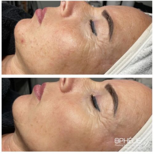 Soins traitants de la peau - Institut de beauté à Grésy sur Aix