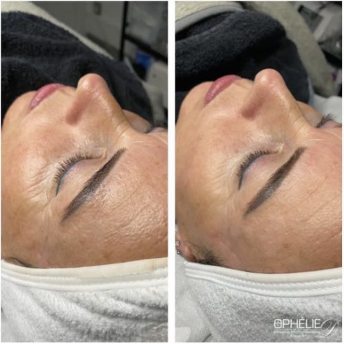 Soins traitants de la peau - Institut de beauté à Grésy sur Aix