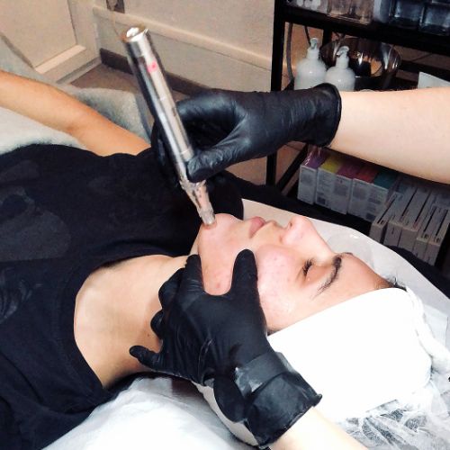 Soins traitants de la peau - Institut de beauté à Grésy sur Aix