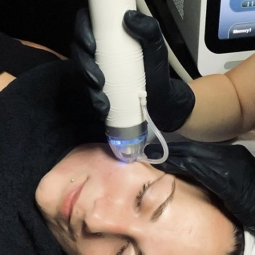 Soins traitants de la peau - Institut de beauté à Grésy sur Aix