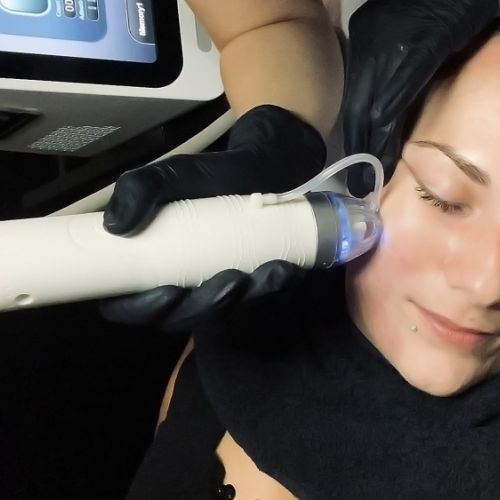 Soins traitants de la peau - Institut de beauté à Grésy sur Aix