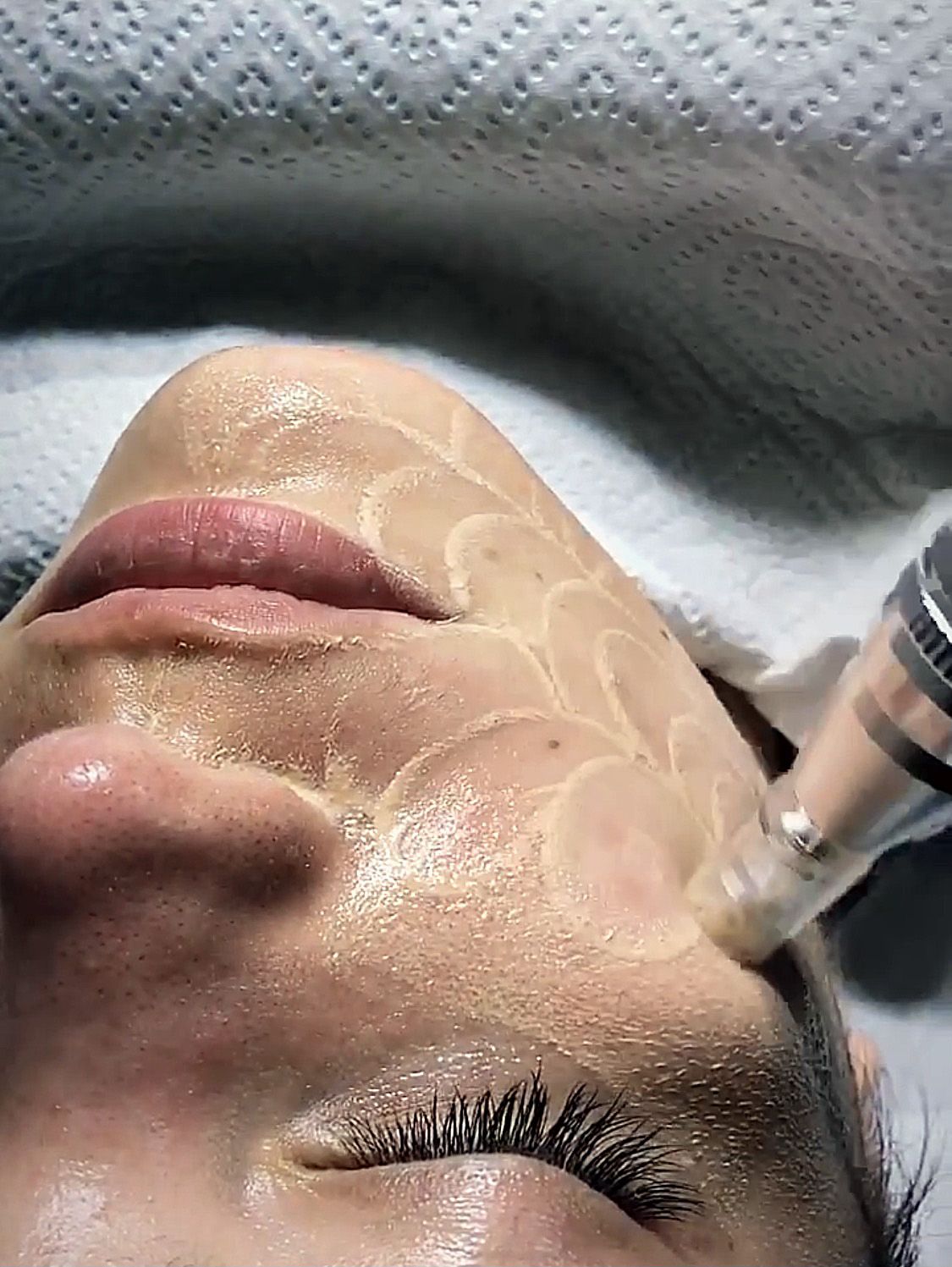 Soins traitants de la peau - Institut de beauté à Grésy sur Aix